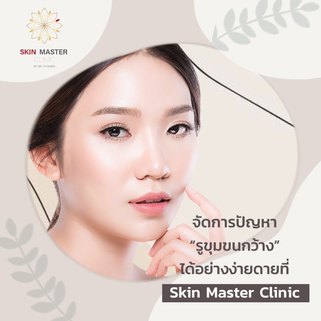 จัดการปัญหา “รูขุมขนกว้าง” ได้อย่างง่ายดาย ที่ Skin Master Clinic