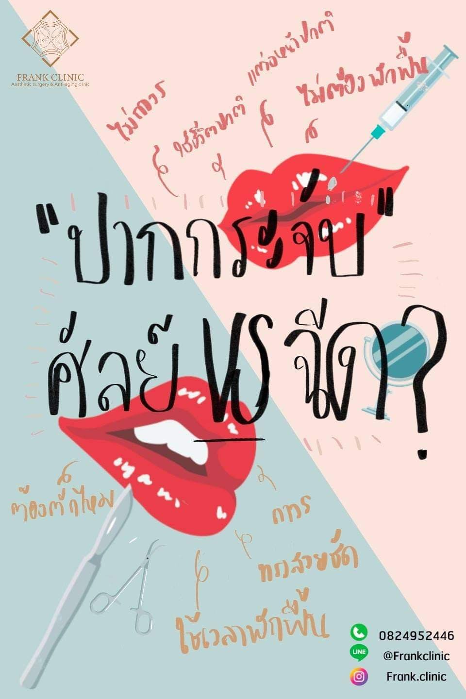 ศัลยกรรมปากกระจับ จะศัลย์ หรือ จะฉีด ดี?  ศัลยกรรมปากกระจับ จะศัลย์ หรือ จะฉีด ดี?