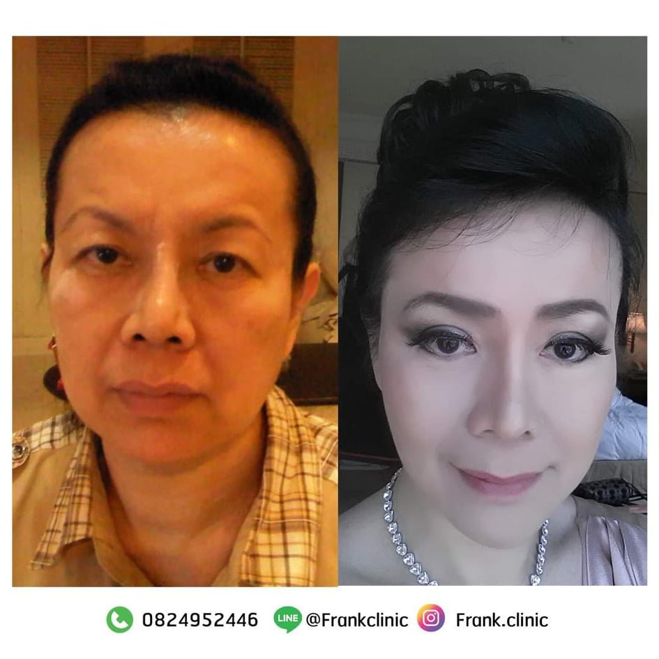 รีวิว จากคุณแม่ของคุณหมอนิโกะ ทำอะไรมาบ้าง? ทำไมหน้ายังเด็กขนาดนี้! รีวิว จากคุณแม่ของคุณหมอนิโกะ ทำอะไรมาบ้าง? ทำไมหน้ายังเด็กขนาดนี้!