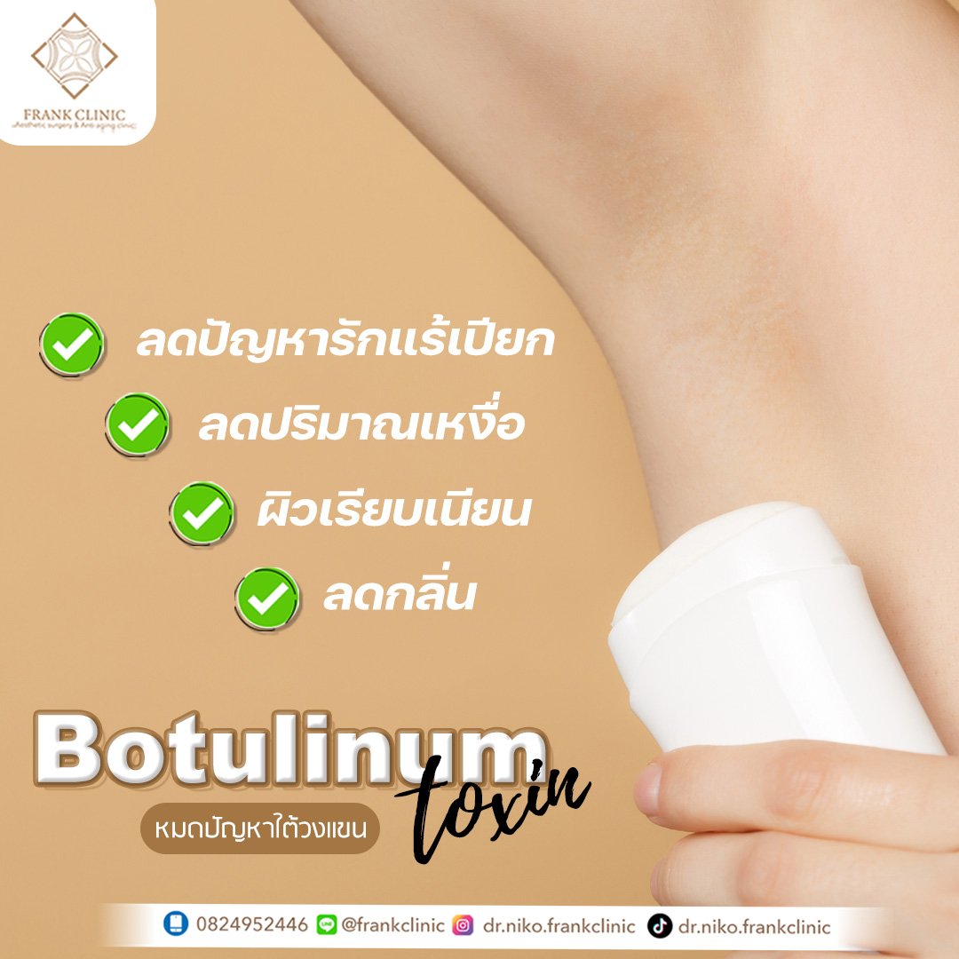 ปัญหารักแร้เปียกแฉะ มีกลิ่นกาย จัดการได้ด้วย น้องโบ(Botulinum toxin) ที่รักแร้ ลดเหงื่อ ลดกลิ่นตัว