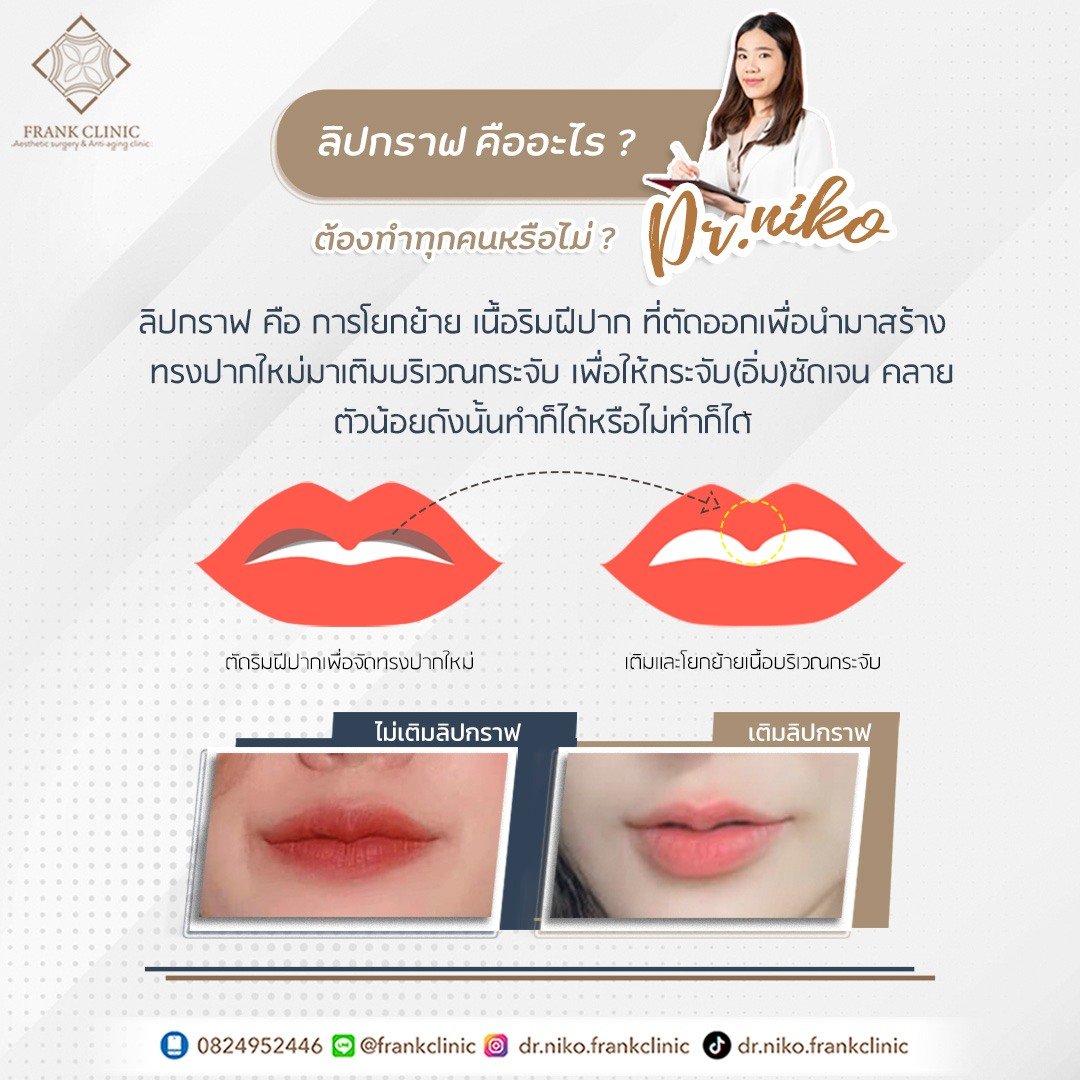 ลิปกราฟ คืออะไร? แล้วจำเป็นต้องทำทุกเคสไหม? ลิปกราฟ คืออะไร? แล้วจำเป็นต้องทำทุกเคสไหม?