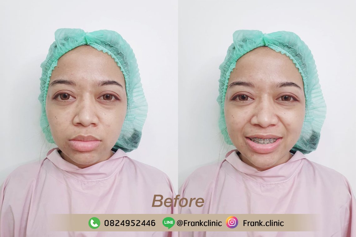 รีวิวดีดี เน้น เน้น วันต่อวันกับคุณ Marty ที่ได้ปากกระจับสวยรับกับตากลมโตของเธอ รีวิวดีดี เน้น เน้น วันต่อวันกับคุณ Marty ที่ได้ปากกระจับสวยรับกับตากลมโตของเธอ