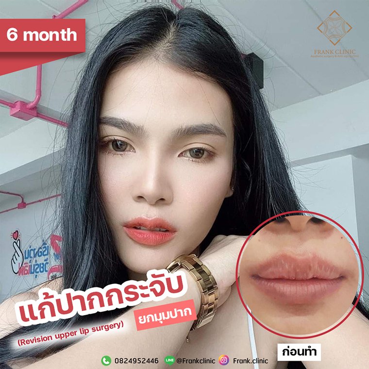 รีวิว คุณ แต้ว เน็ตไอดอล สาวสวยจาก TIKTOK ผู้ติดตามกว่า 1.6 ล้านคน