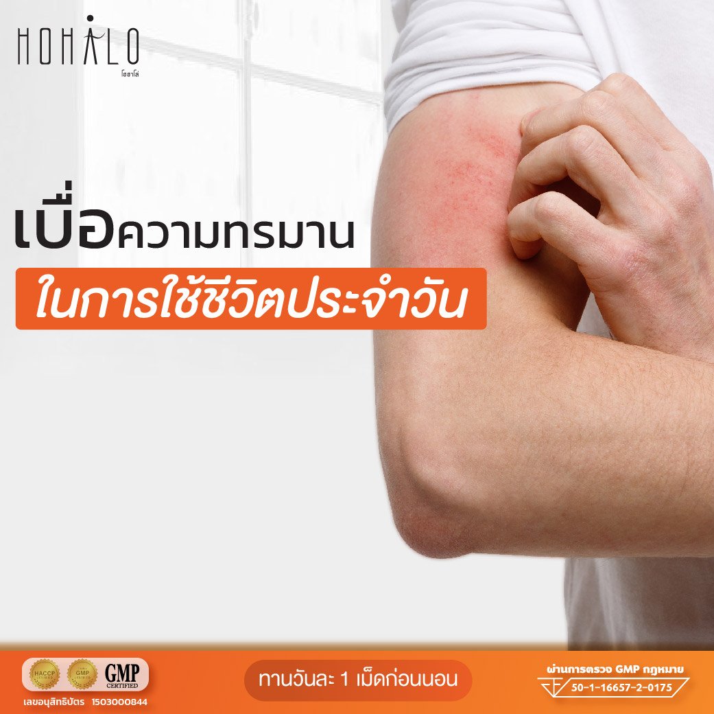 อาการของโรคผิวหนังอักเสบเรื้อรังอย่าง “สะเก็ดเงิน” อาการของโรคผิวหนังอักเสบเรื้อรังอย่าง “สะเก็ดเงิน”