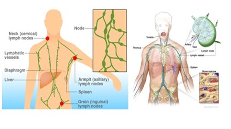 ? : มะเร็งต่อมน้ำเหลืองคืออะไร ? : มะเร็งต่อมน้ำเหลืองคืออะไร