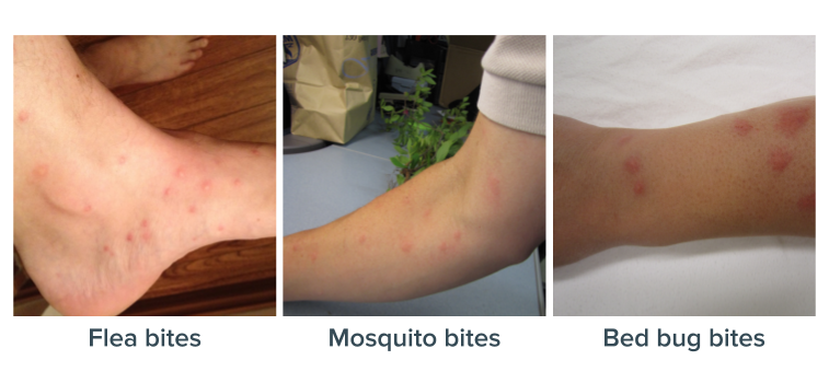 “ขาลาย...เพราะ #น้ำเหลืองไม่ดี” “ขาลาย...เพราะ #น้ำเหลืองไม่ดี”