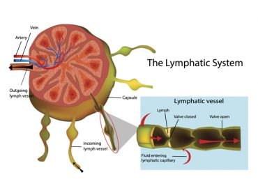 สาเหตุของภาวะน้ำเหลืองไม่ดี สาเหตุของภาวะน้ำเหลืองไม่ดี