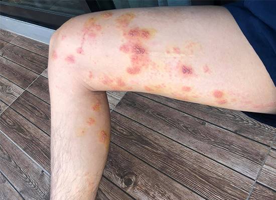 สถานการณ์แบบนี้ ภูมิตก ป่วยบ่อย ไม่ดีแน่! สถานการณ์แบบนี้ ภูมิตก ป่วยบ่อย ไม่ดีแน่!