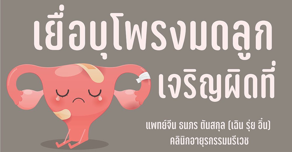 เยื่อบุโพรงมดลูกเจริญผิดที่ Chocolate Cyst รักษาด้วยศาสตร์แพทย์จีน 