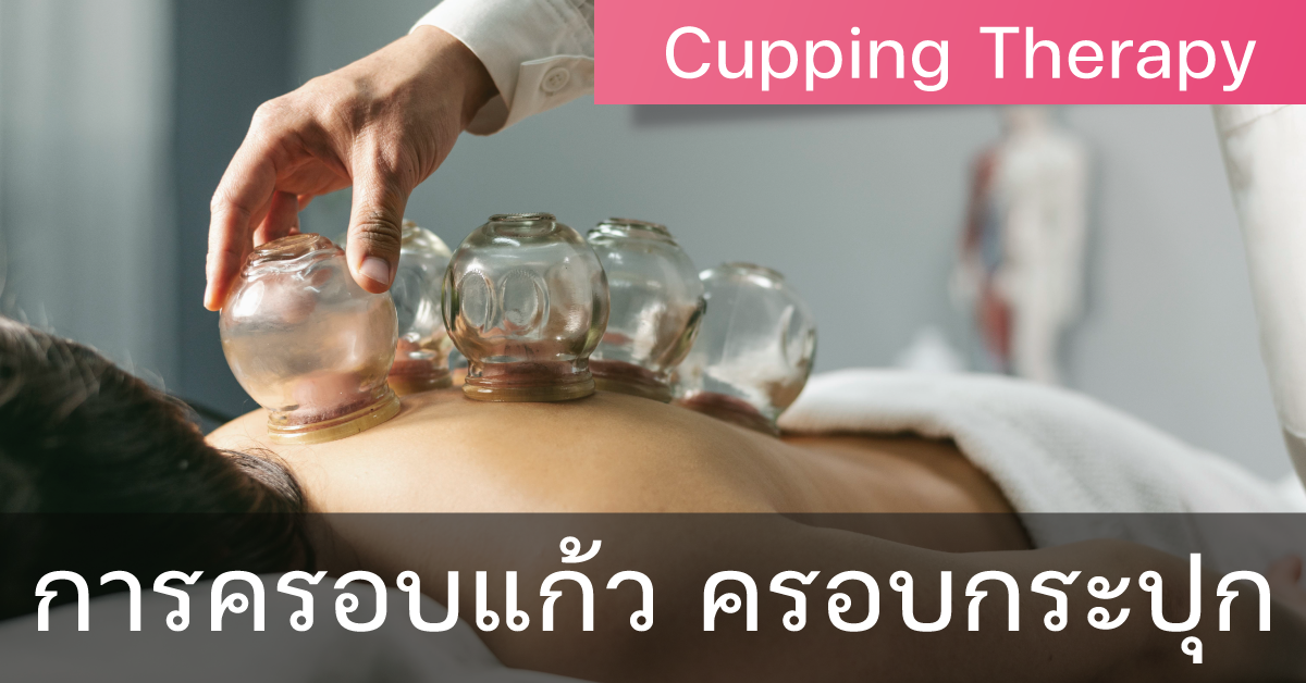 การครอบแก้ว ครอบกระปุก (Cupping Therapy)