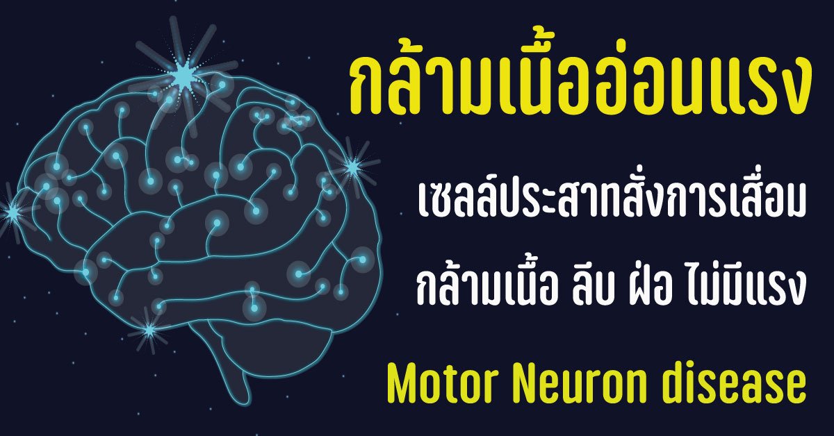 กล้ามเนื้ออ่อนแรง อัมพาตเฉียบพลัน Motor Neuron disease