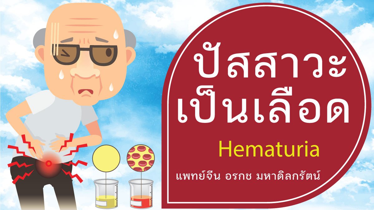 ปัสสาวะเป็นเลือด รักษาด้วยวิธีแพทย์แผนจีน