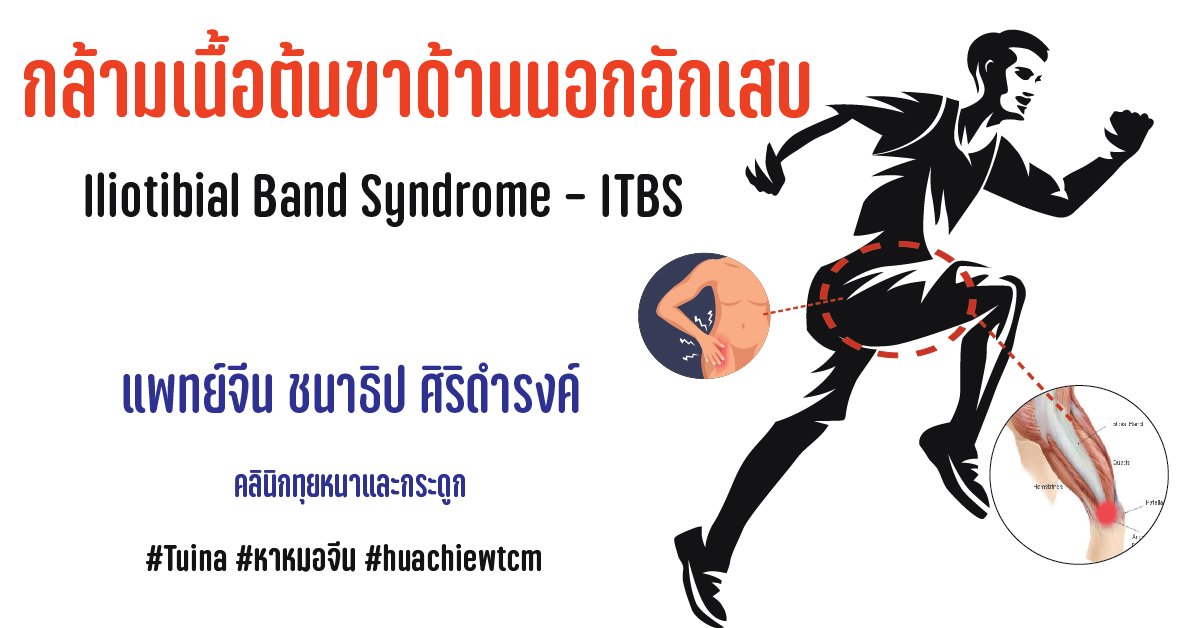 โรคกล้ามเนื้อต้นขาด้านนอกอักเสบ Iliotibial Band Syndrome – ITBS 
