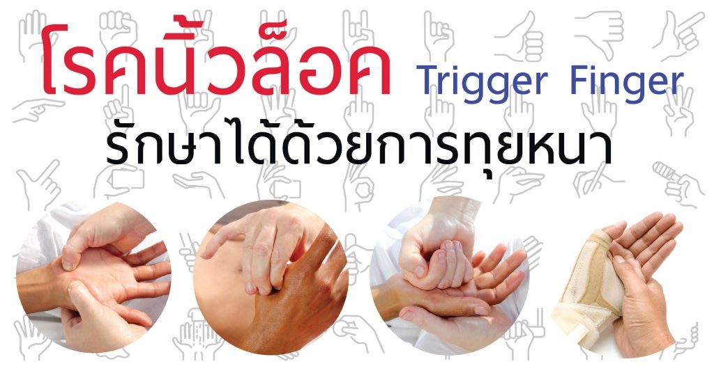 นวดทุยหนารักษาโรคนิ้วล็อค Trigger Finger