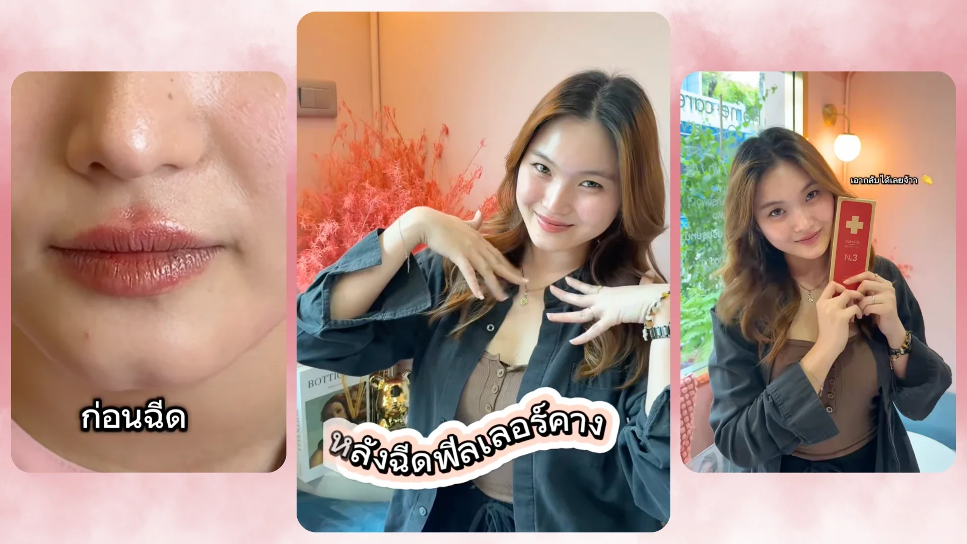 รีวิวฟิลเลอร์แท้