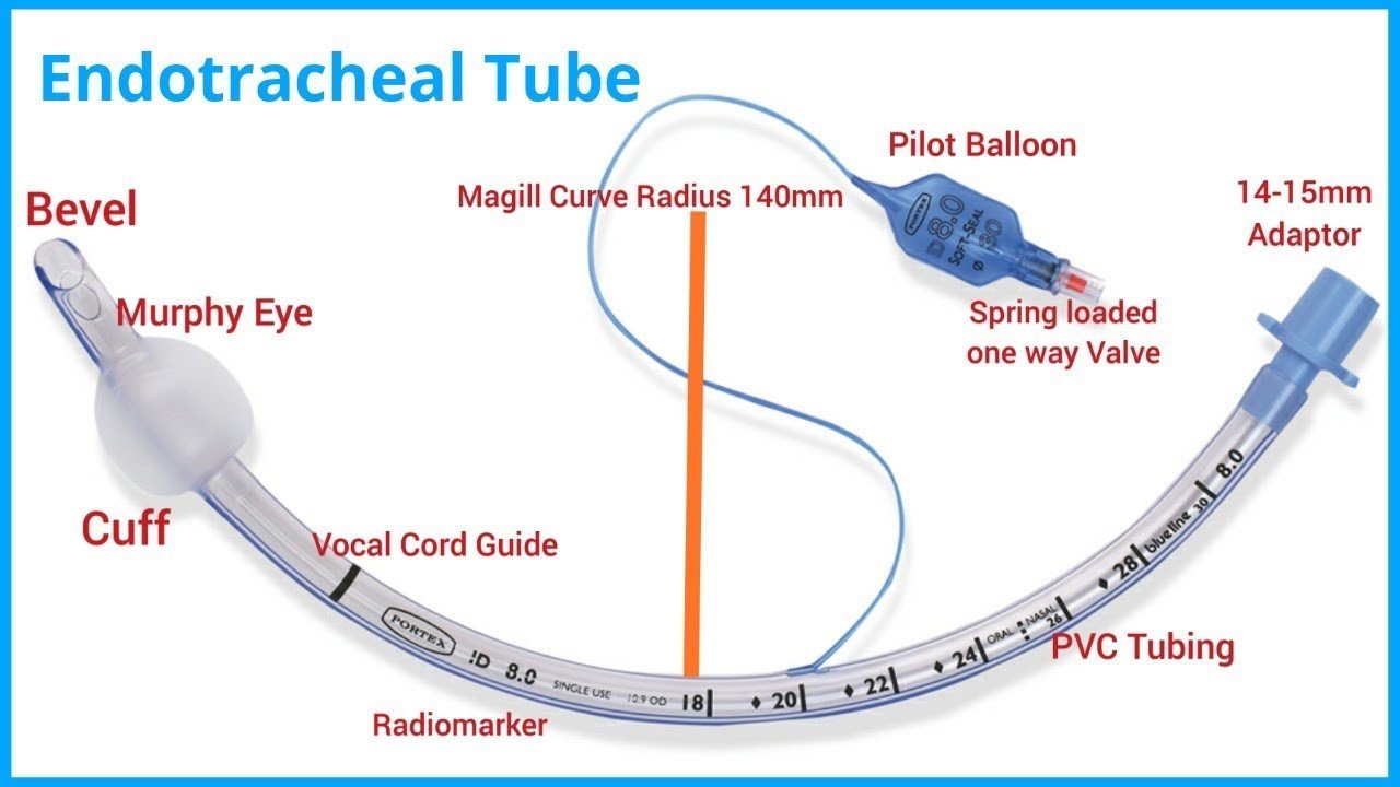 Mengenal Endotracheal Tube, Alat Bantu Nafas Buatan Medis Darurat