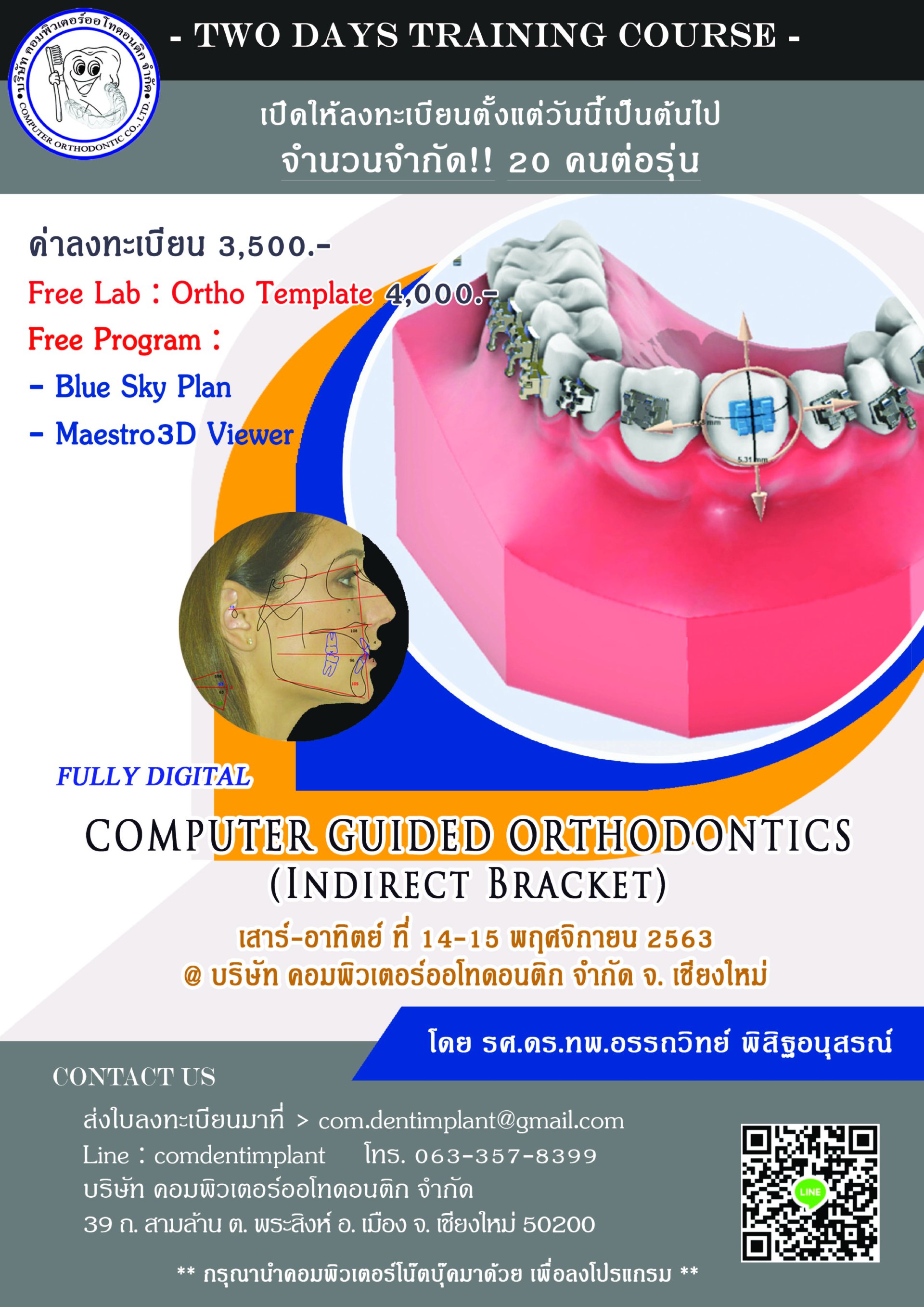 Indirect Bracket Dr.Attawit