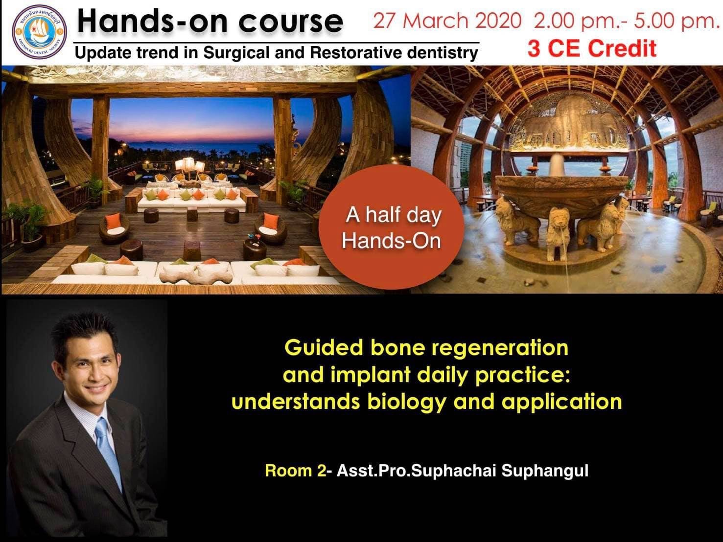 Hands On Implant