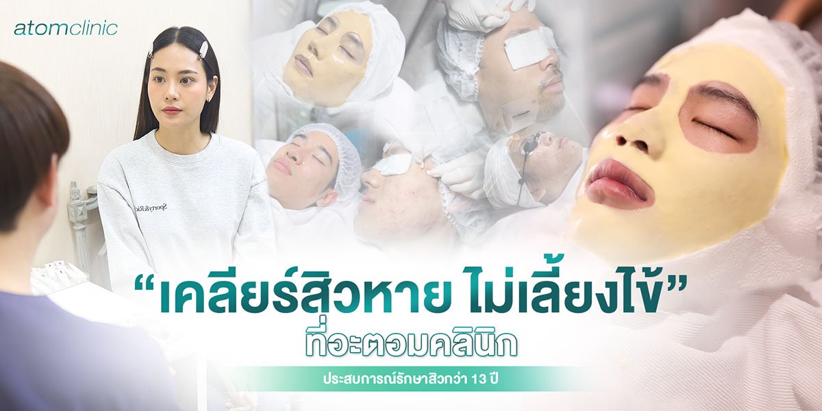 รักษาสิว สิวอักเสบ สิวอุดตัน อะตอมคลินิก