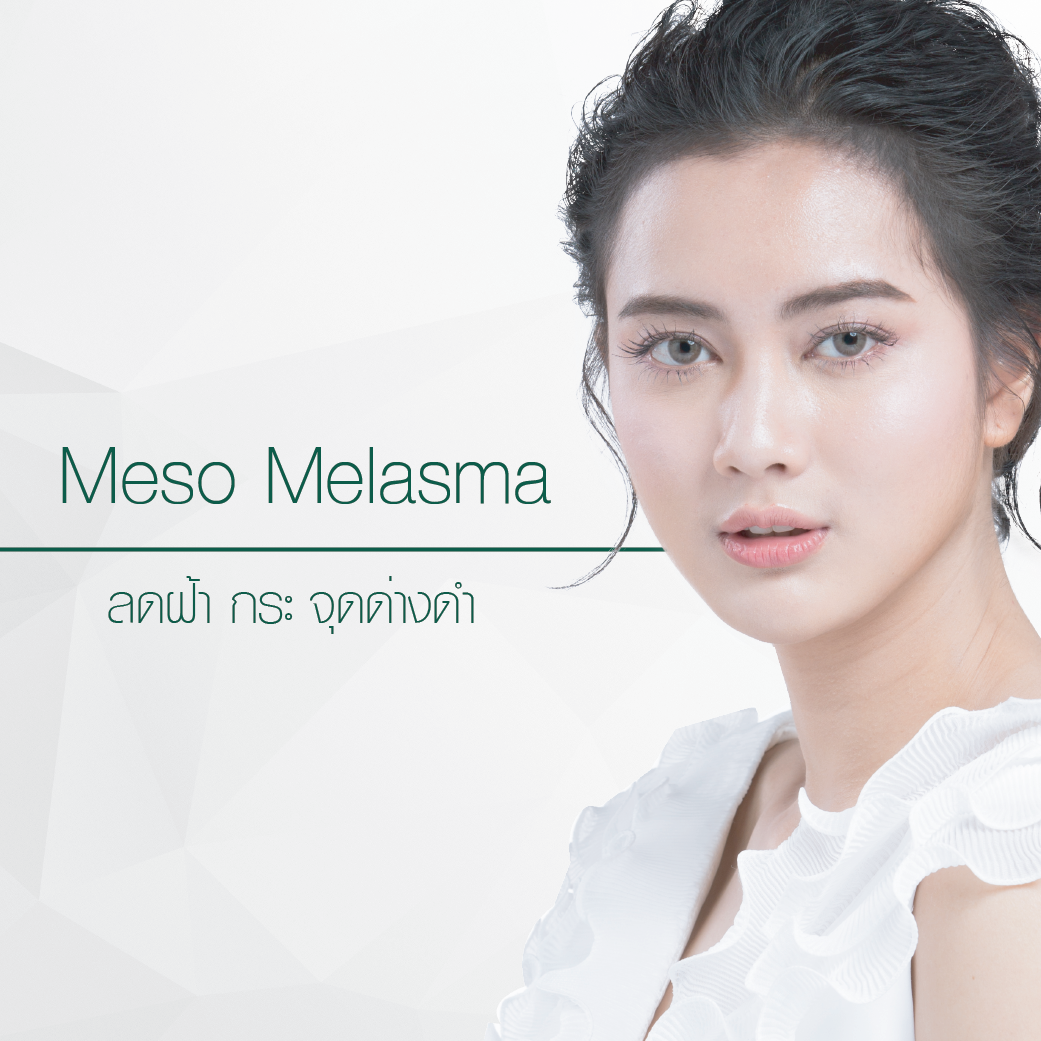 MESO MELASMA