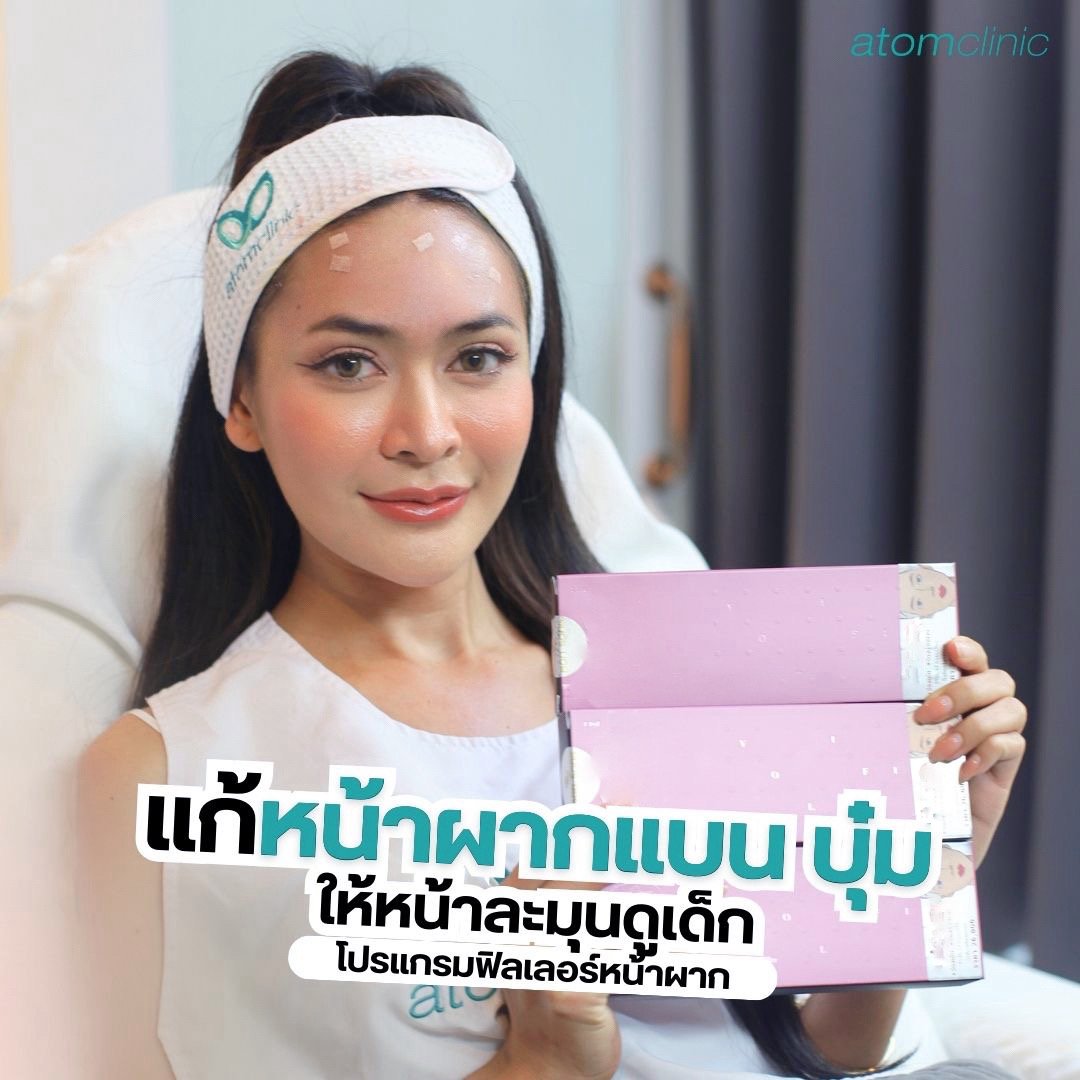 ฟิลเลอร์หน้าผาก เติมความละมุน ปรับโหงวเฮ้งให้ดูเด็กขึ้น! ฟิลเลอร์หน้าผาก เติมความละมุน ปรับโหงวเฮ้งให้ดูเด็กขึ้น!