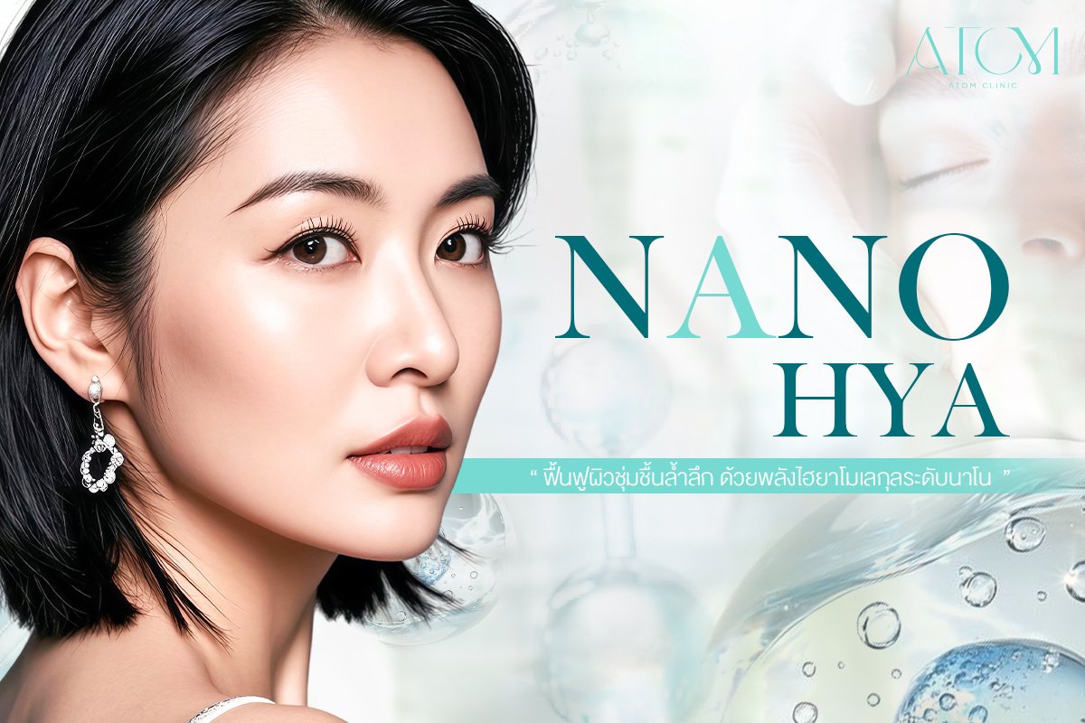 Nano Hya