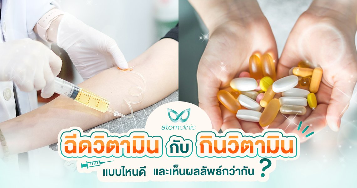การฉีดวิตามิน กับ การกินวิตามิน ต่างกันอย่างไร แบบไหนดีกว่ากัน การฉีดวิตามิน กับ การกินวิตามิน ต่างกันอย่างไร แบบไหนดีกว่ากัน