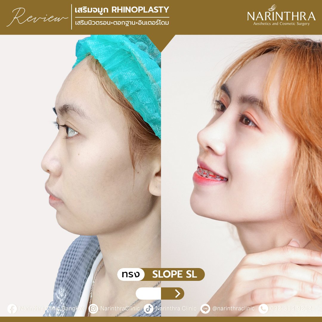  รีวิวclosed 6
