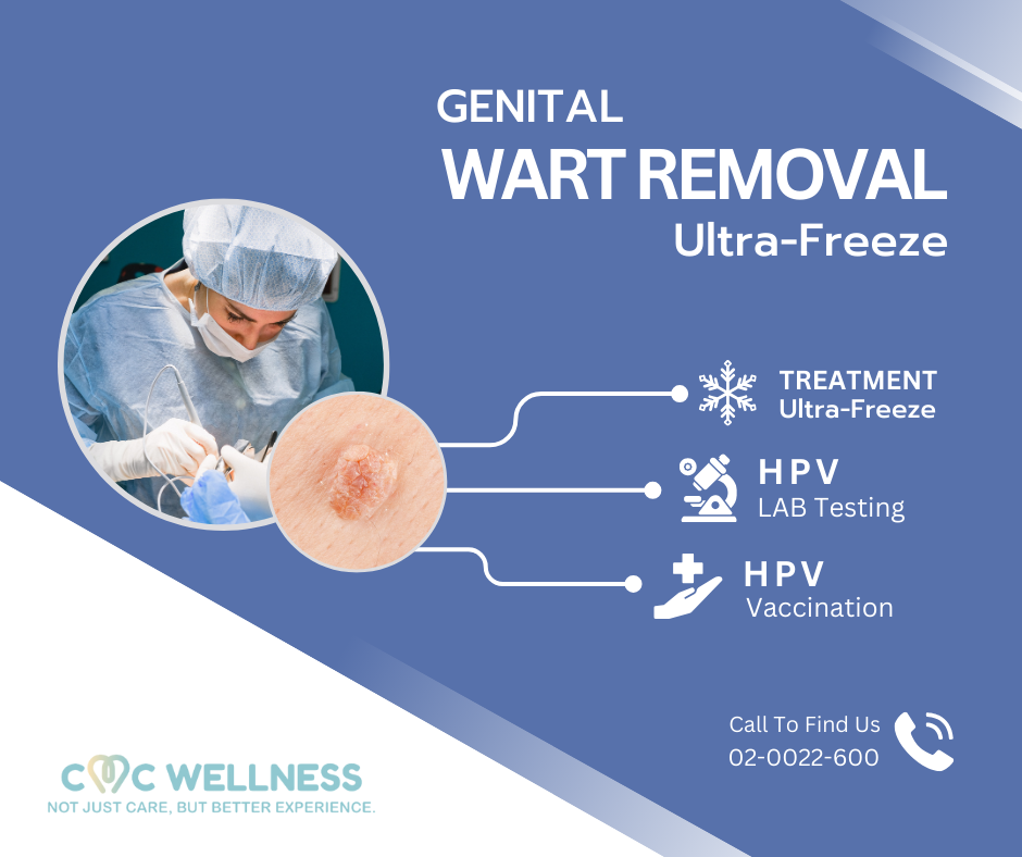 รักษาหูดหงอนไก่ด้วยการจี้เย็น (Cryotherapy) | CMC Wellness รักษาหูดหงอนไก่ด้วยการจี้เย็น (Cryotherapy) | CMC Wellness