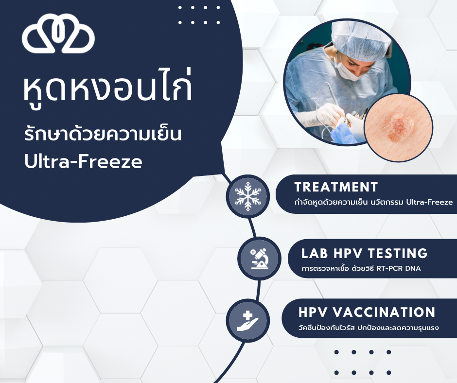 หูดหงอนไก่คืออะไร? สาเหตุ การติดต่อ และวิธีรักษา | CMC Wellness หูดหงอนไก่คืออะไร? สาเหตุ การติดต่อ และวิธีรักษา | CMC Wellness