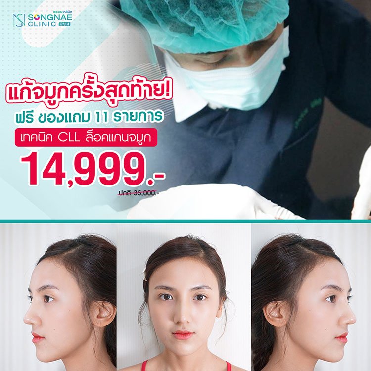 แก้จมูก