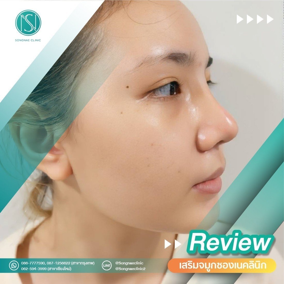 Review SongnaeClinic