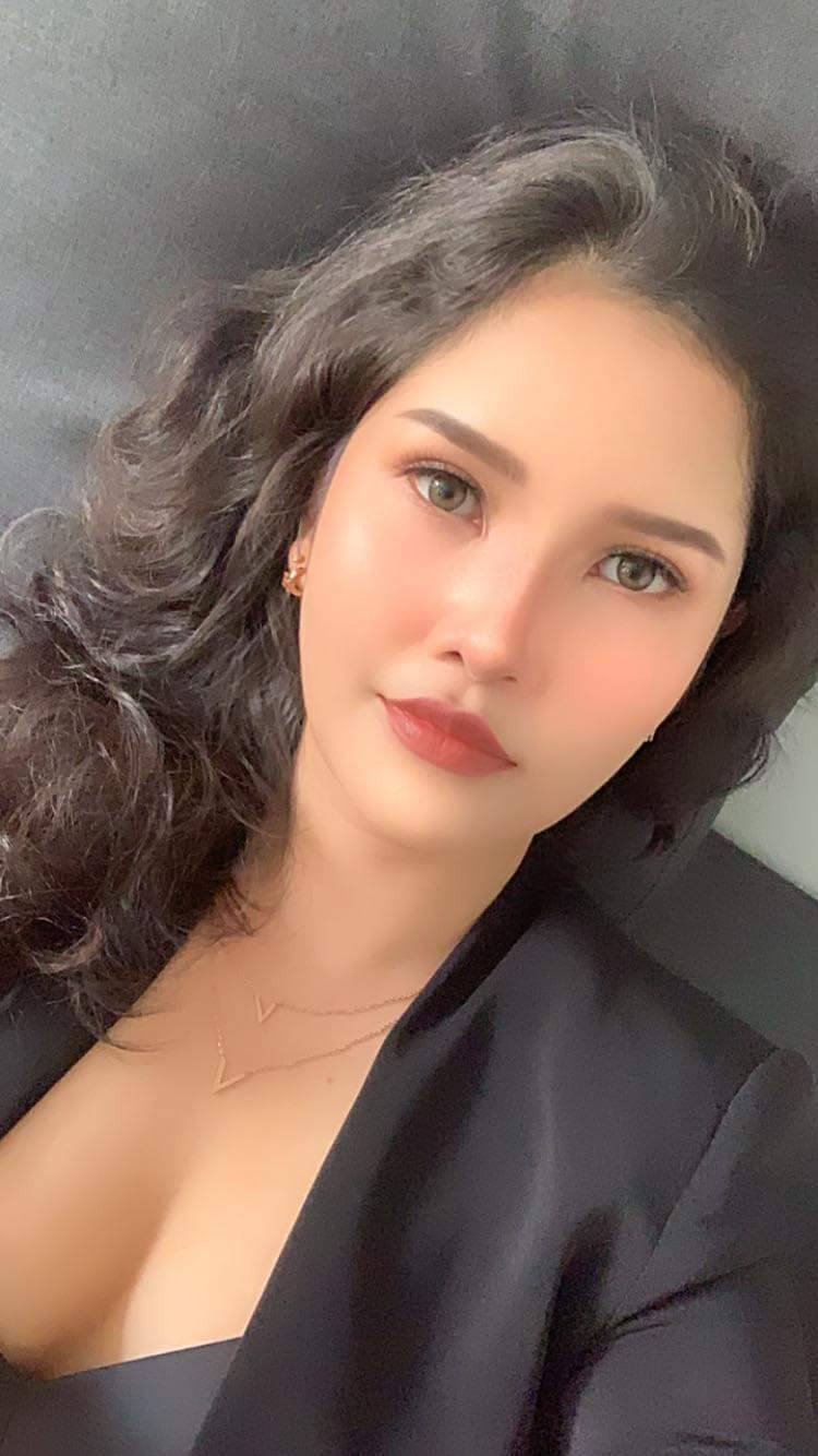  รีวิวจากคุณอ้อม_หลังเสริมจมูกกับคุณหมอบิ๊ก