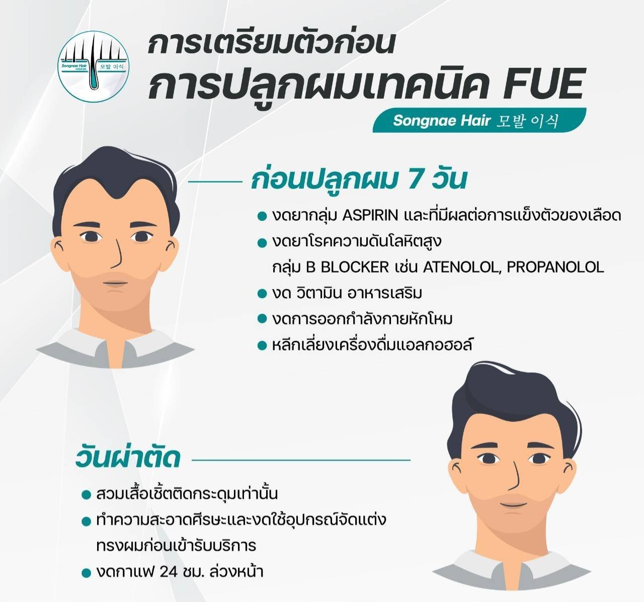 เตรียมตัวก่อนปลูกผม FUE
