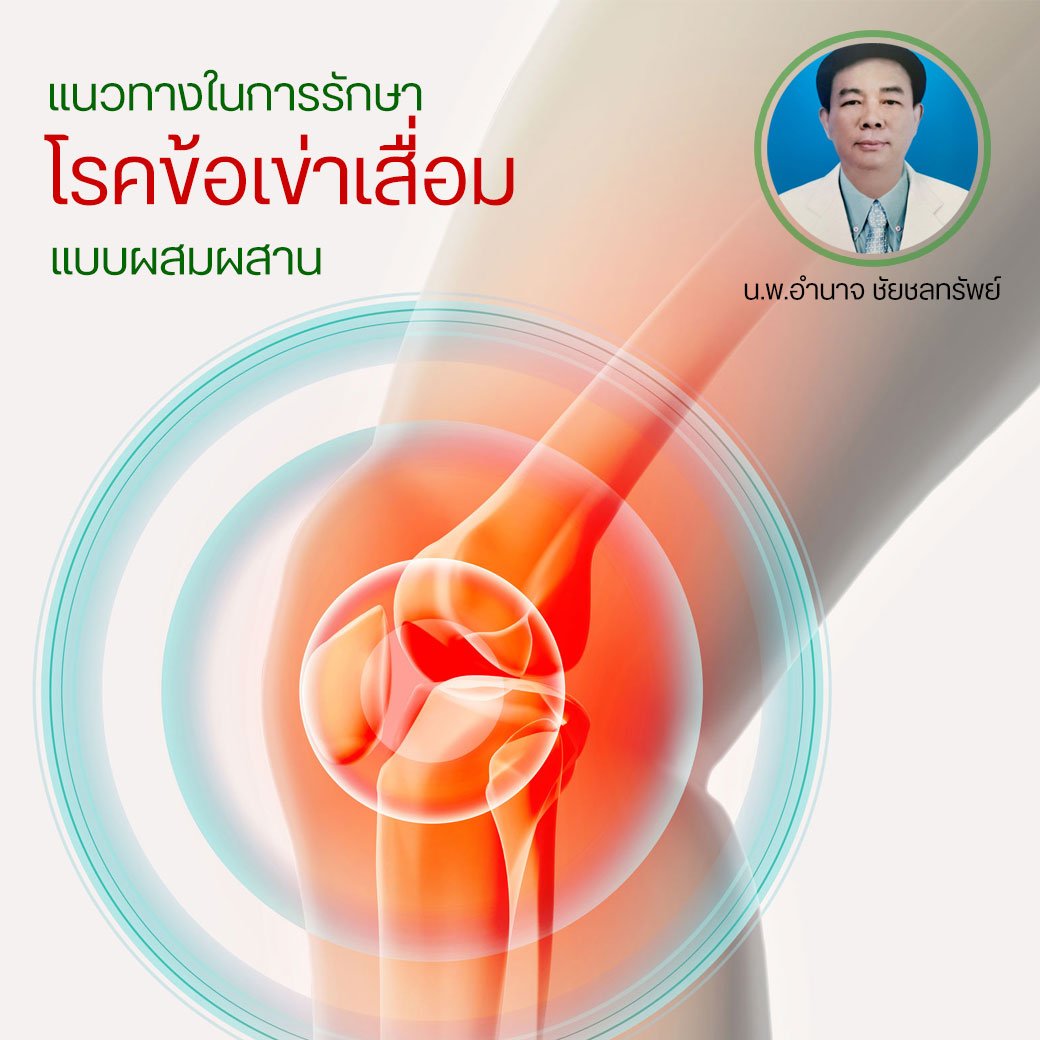 แนวทางในการรักษาโรคข้อเข่าเสื่อมแบบผสมผสาน