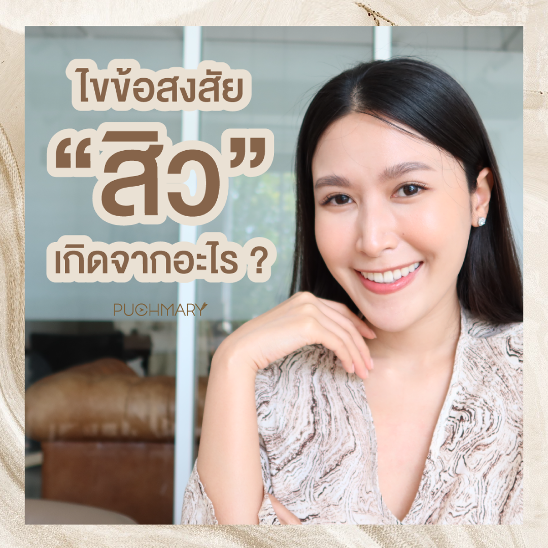 #สิว เกิดจากอะไร ไปดูกัน รายละเอียดของภาพสิว