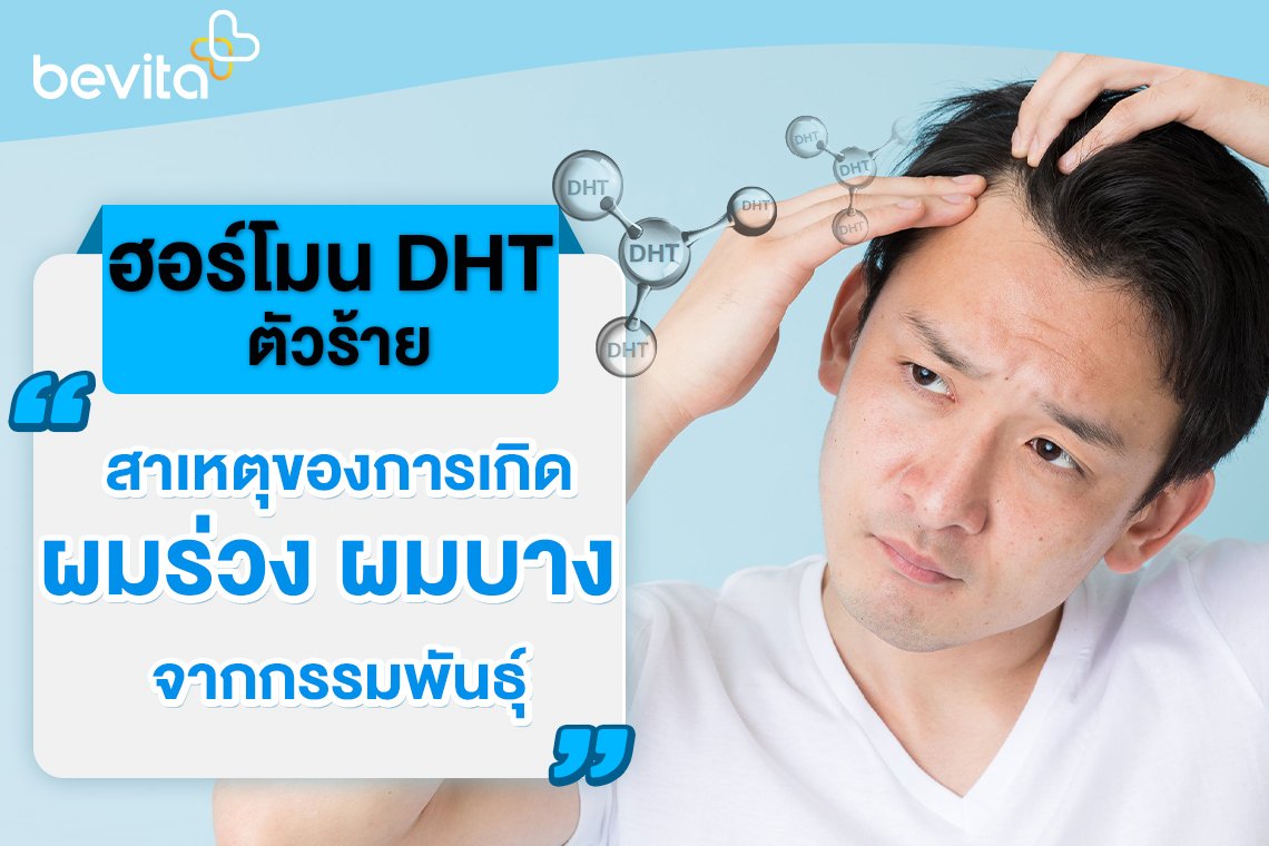 ฮอร์โมน Dht สาเหตุของการเกิดผมร่วง ผมบาง จากกรรมพันธุ์ - Bevita