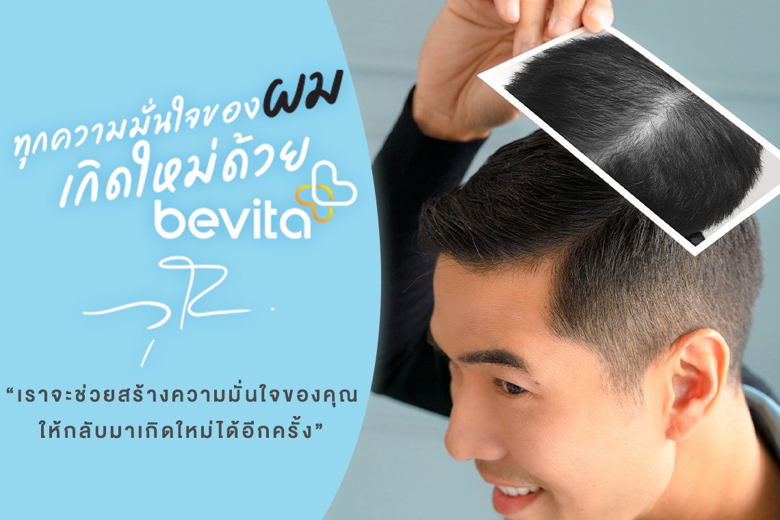 ปัญหาผมร่วง หัวล้าน ไม่ใข่เรื่องเล็กอย่างที่คิด ปัญหาผมร่วง หัวล้าน ไม่ใข่เรื่องเล็กอย่างที่คิด