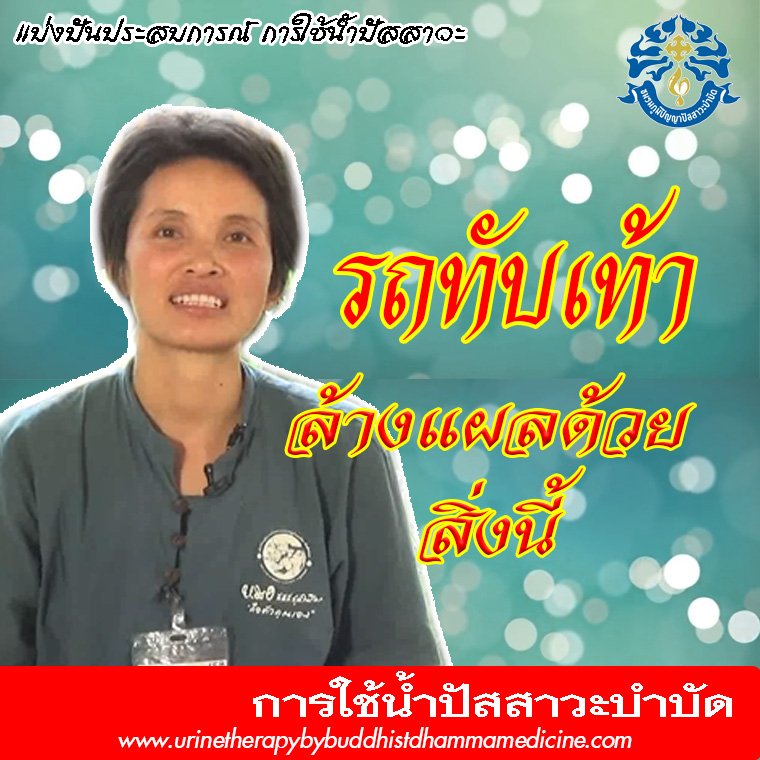 ล้างแผลด้วย น้ำปัสสาวะบำบัด