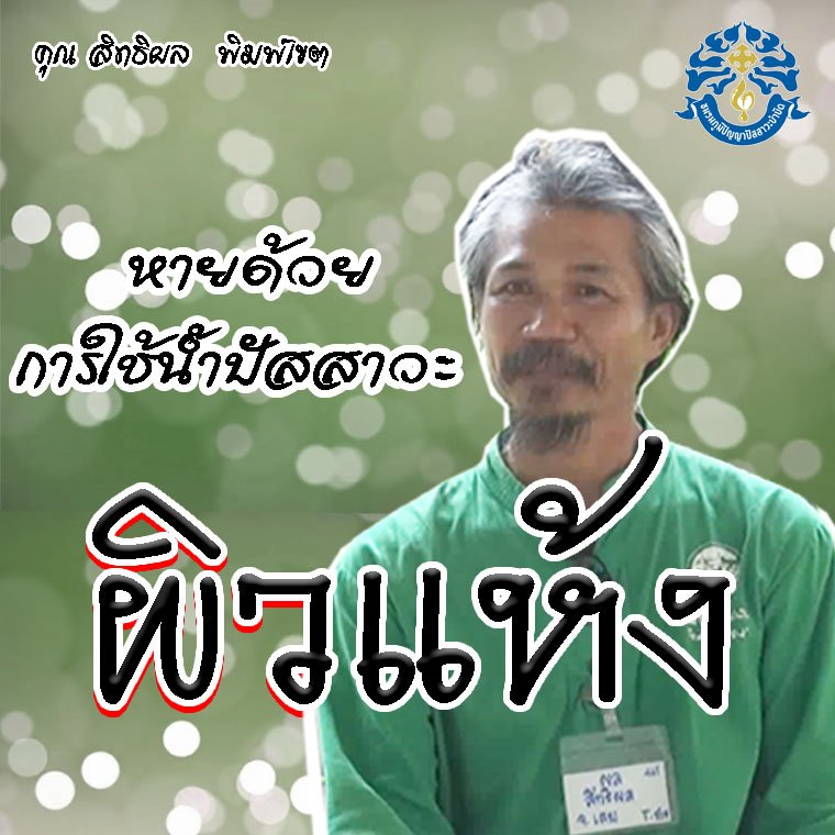 โรคผิวหนังแห้ง แข็ง หายด้วยน้ำปัสสาวะบำบัด
