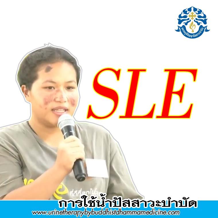 SLE