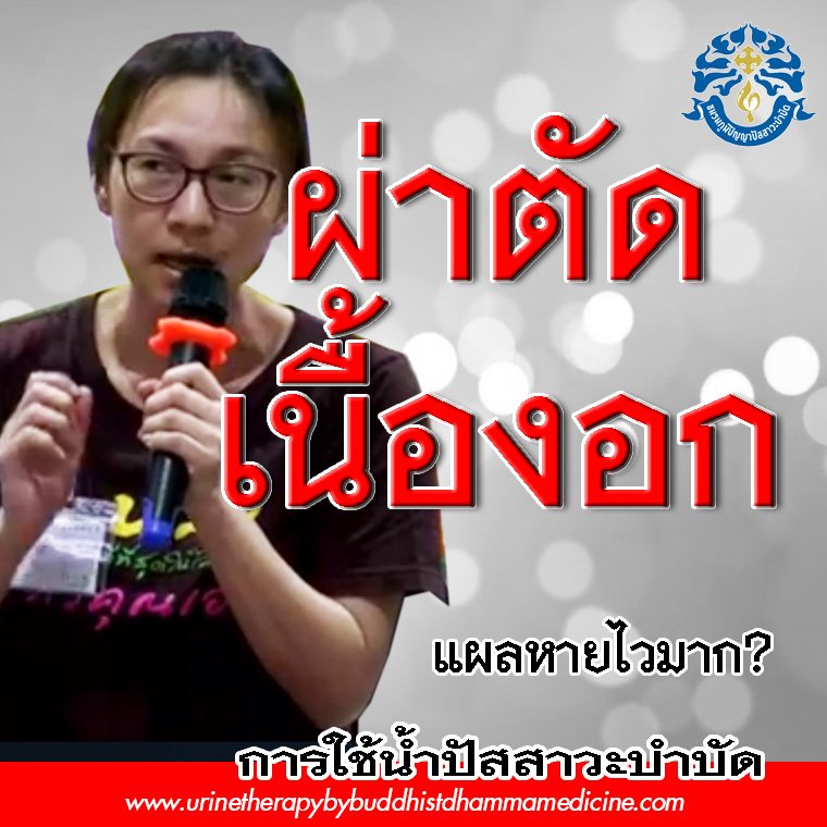 ผ่าตัด เนื้อ งอก