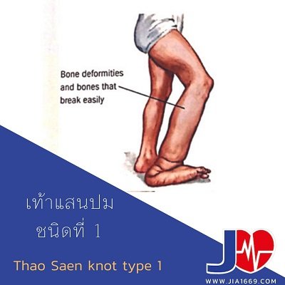 Thao Saen knot type 1