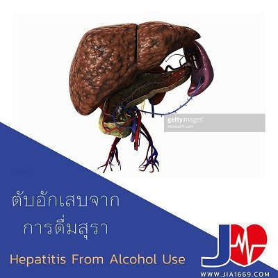 Hepatitis from alcohol use
