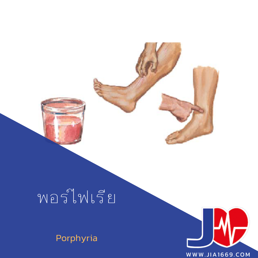 Porphyria 
