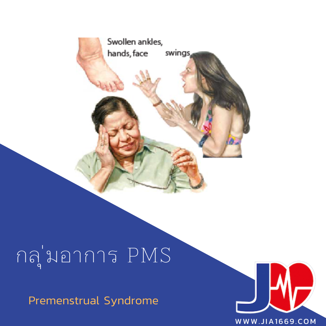 กลุ่มอาการ PMS