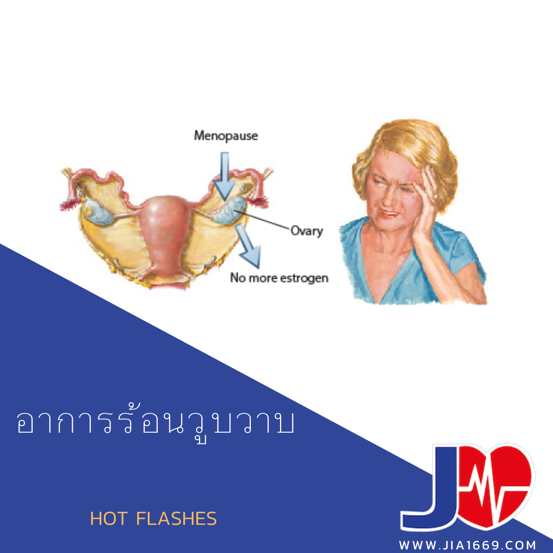 อาการร้อนวูบวาบ