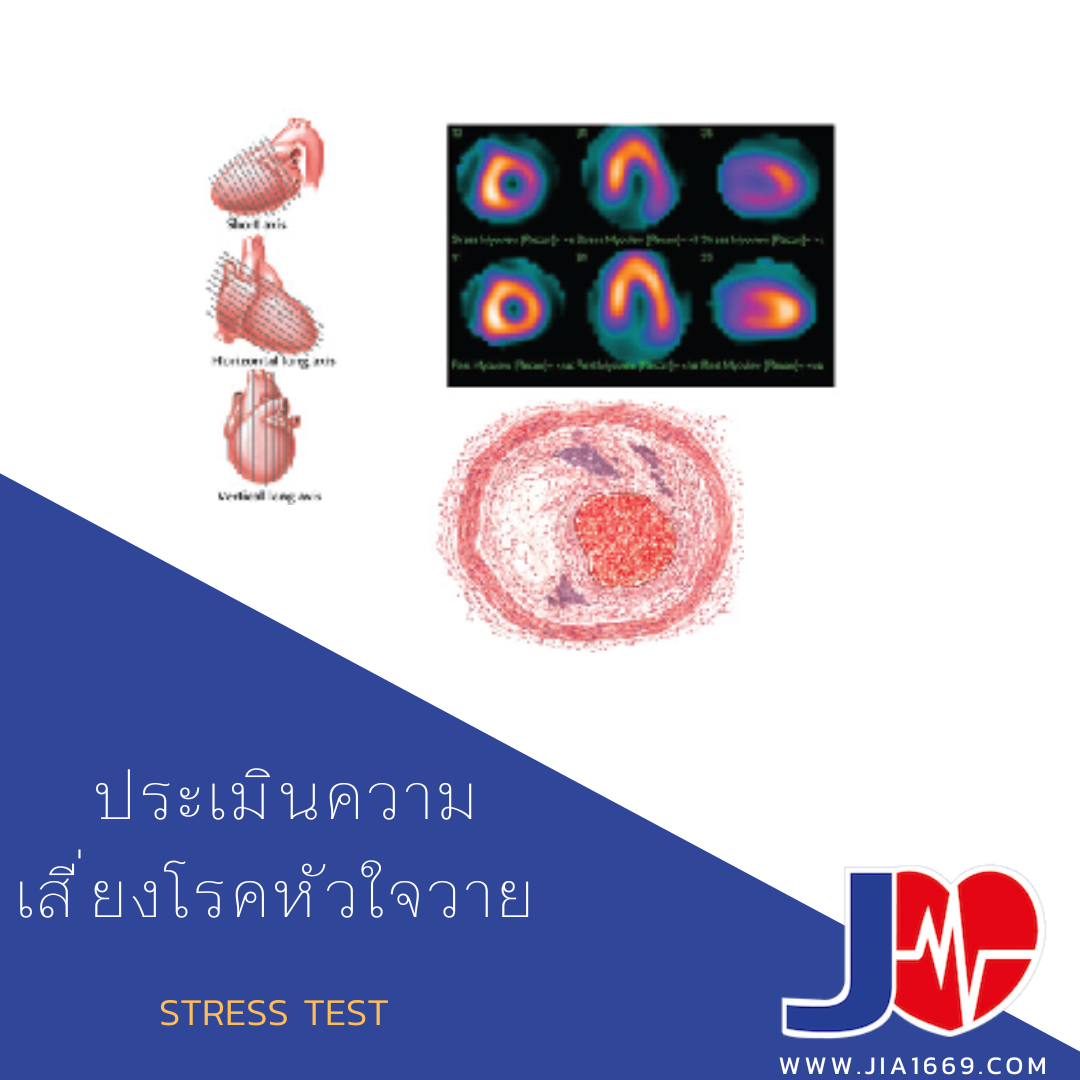 STRESS TEST 