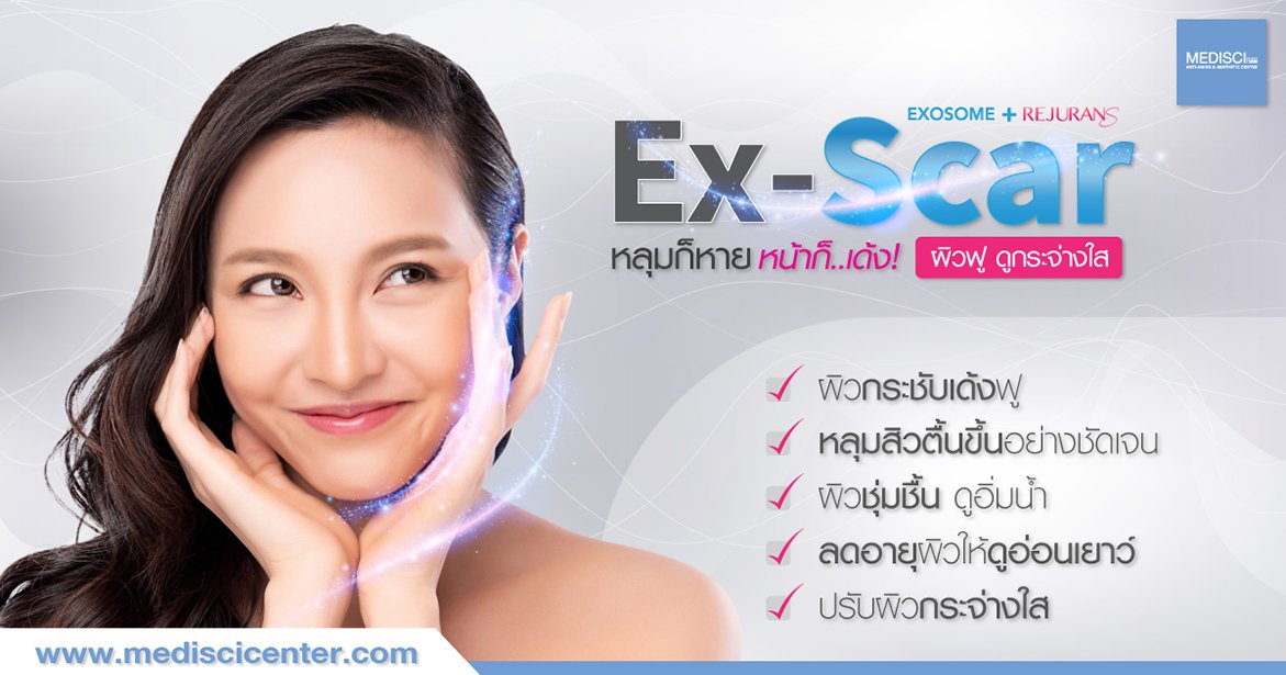โปรโมชั่น Ex-Scar (Exosome + Subcision) + Rejuran