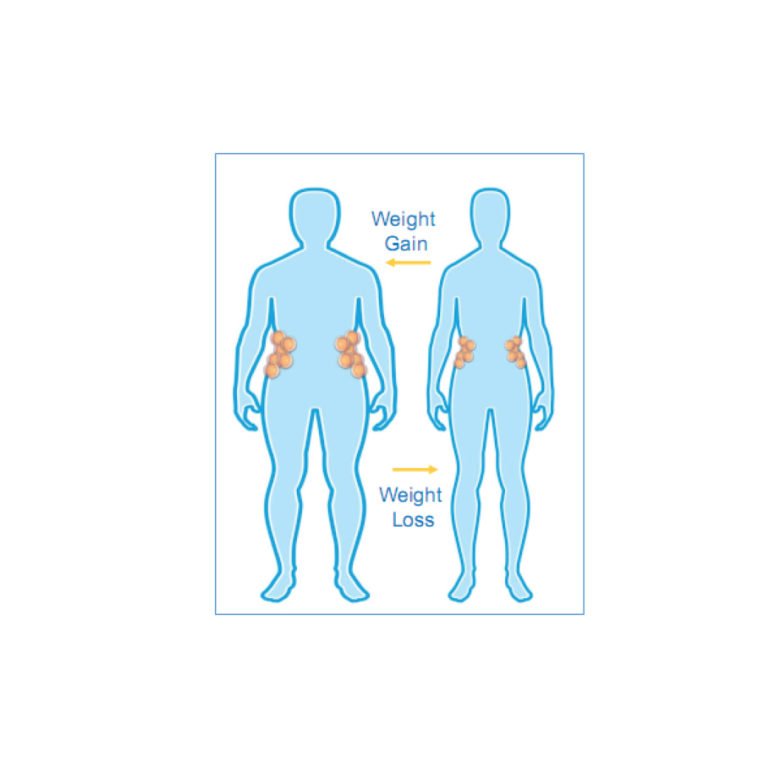 Coolsculpting